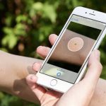 Why the SkinVision app has the potential to save your life